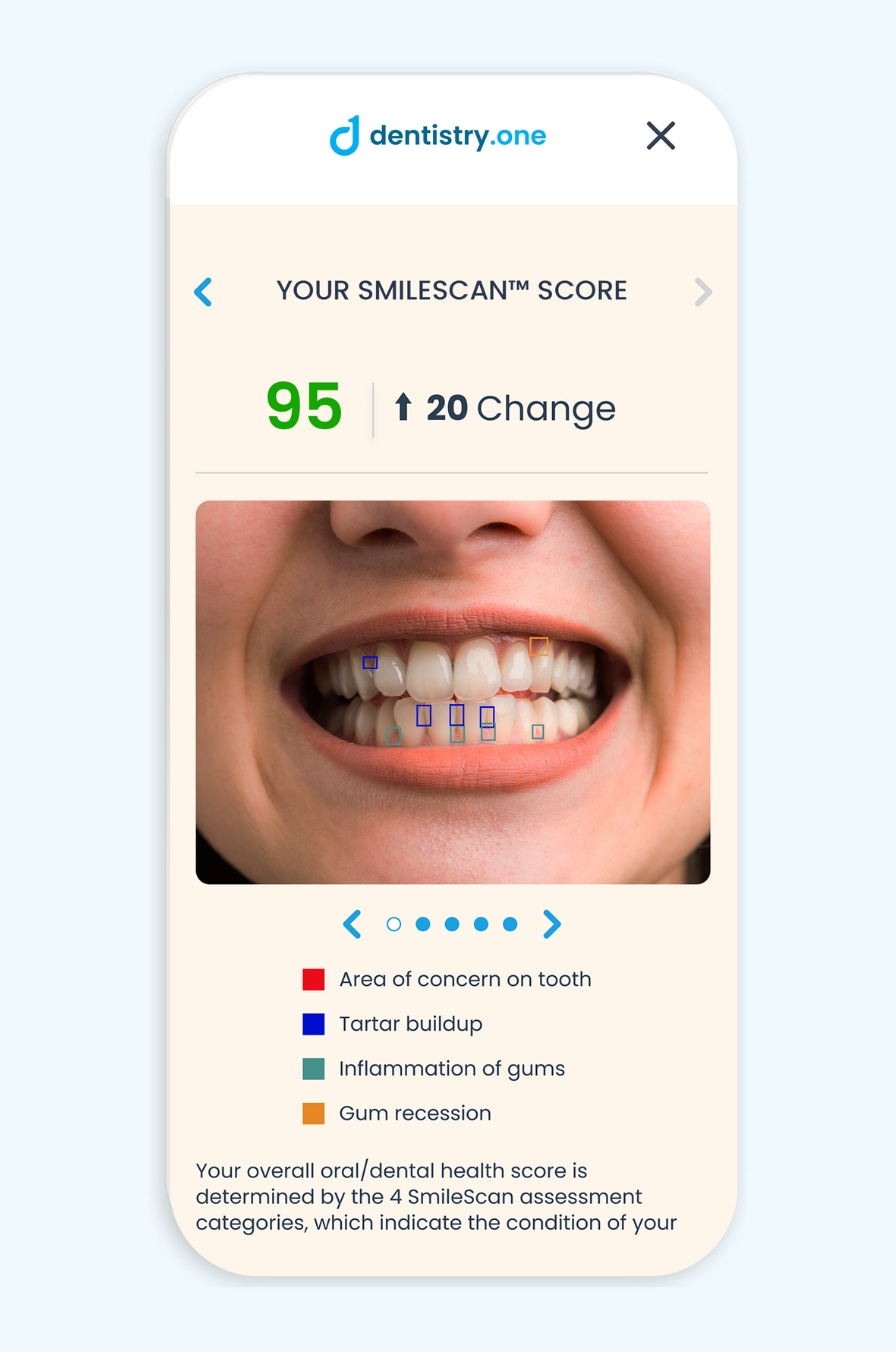 SmileScan Results