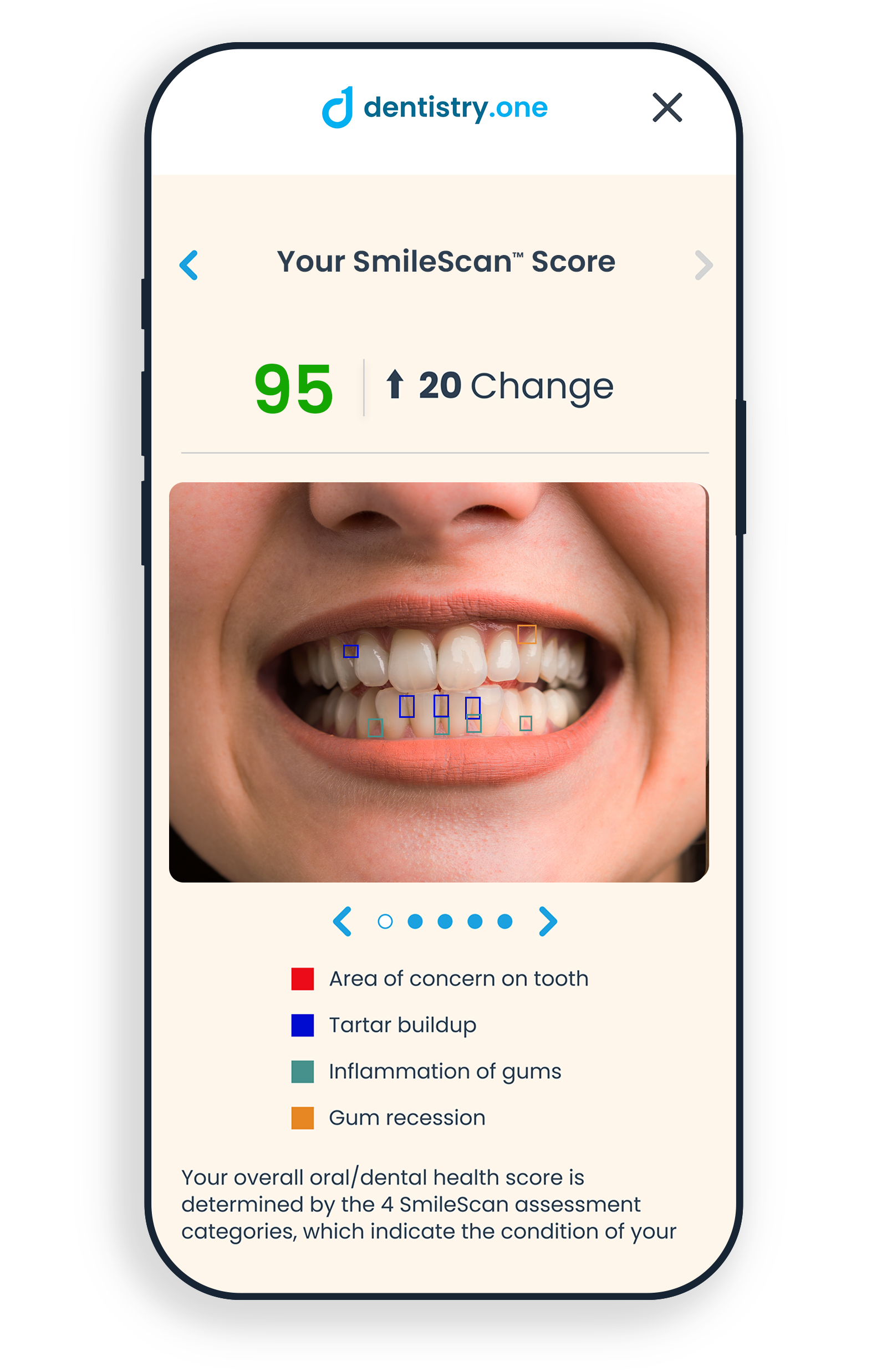 SmileScan results