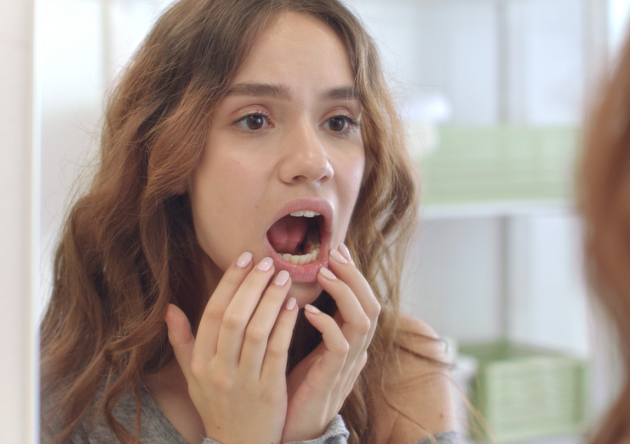 Woman looking in mirror at canker sores in her mouth