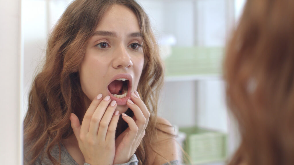 Woman checking mouth for canker sores or mouth sores