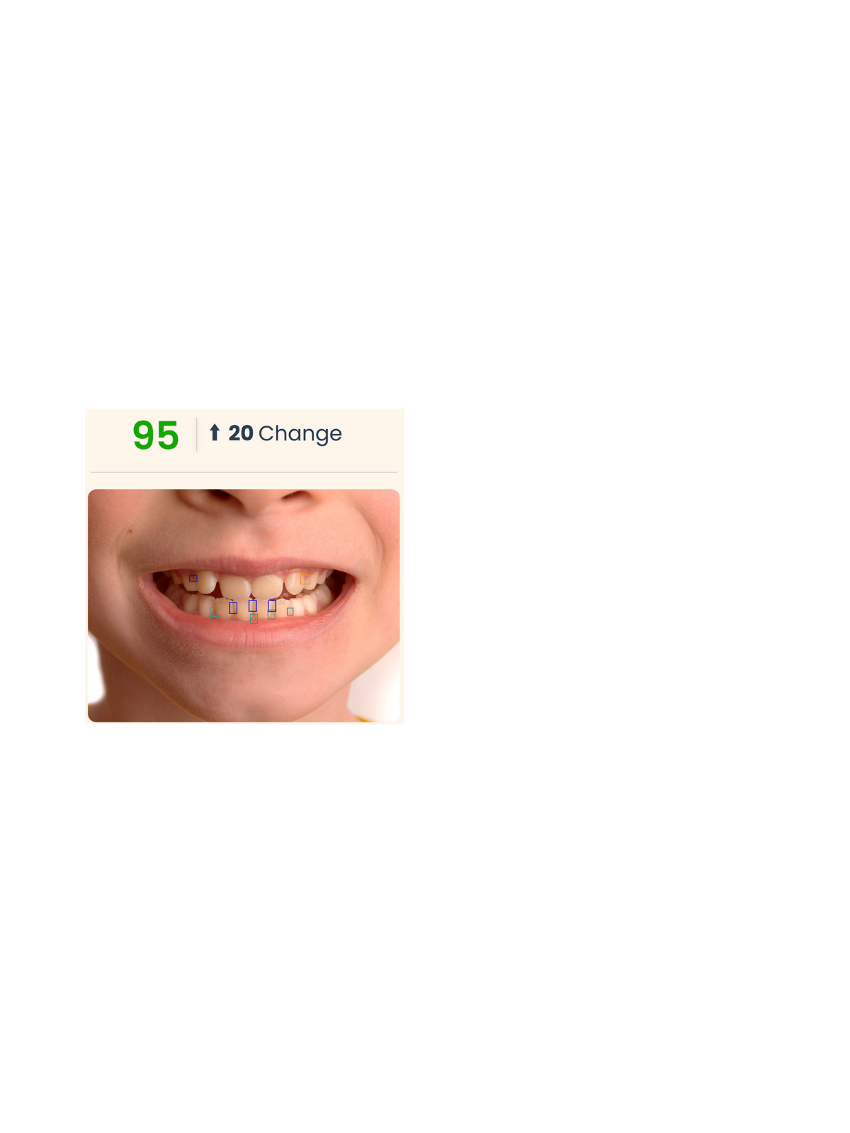 SmileScan
